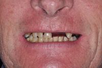 Smile In A Day 7 before